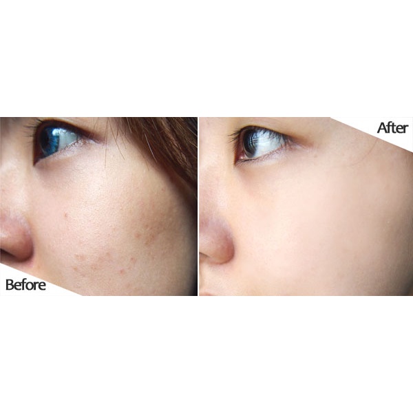 Viên Uống Trắng Da Tổng Hợp  White Glutathione Collagen Vita