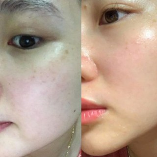 Xịt khoáng La Laesthetics