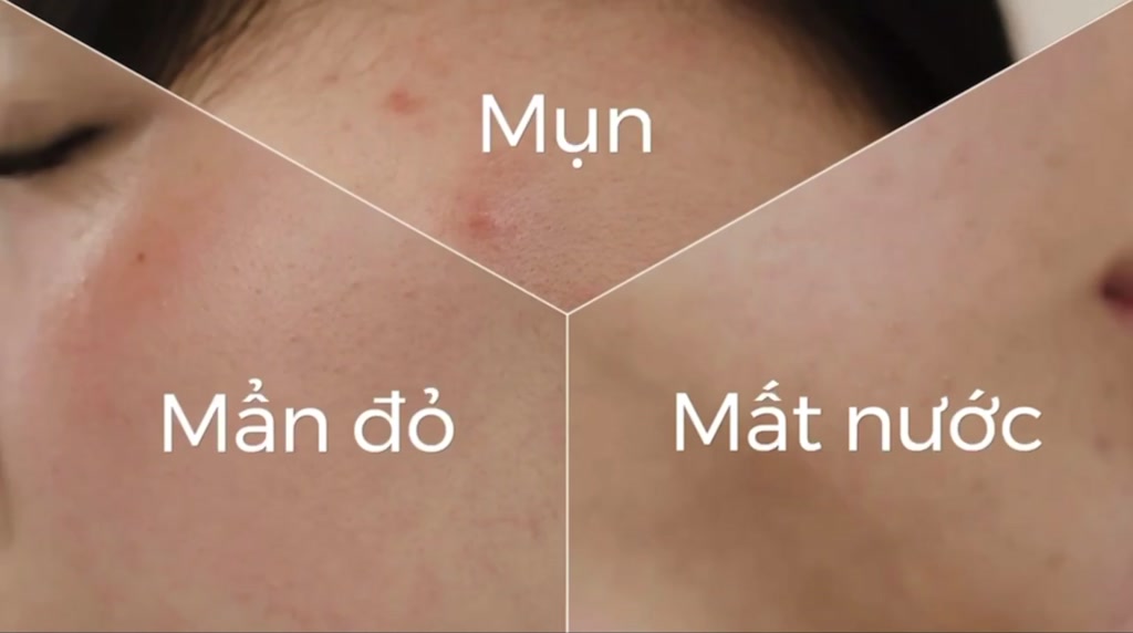 Sữa Rửa Mặt Dạng Gel Cosrx Low pH Good Morning Gel Cleanser | BigBuy360 - bigbuy360.vn