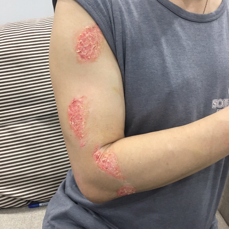 Bình Pro-MEHRON MAKEUP LIQUID LATEX-MSP: BP11-100ml