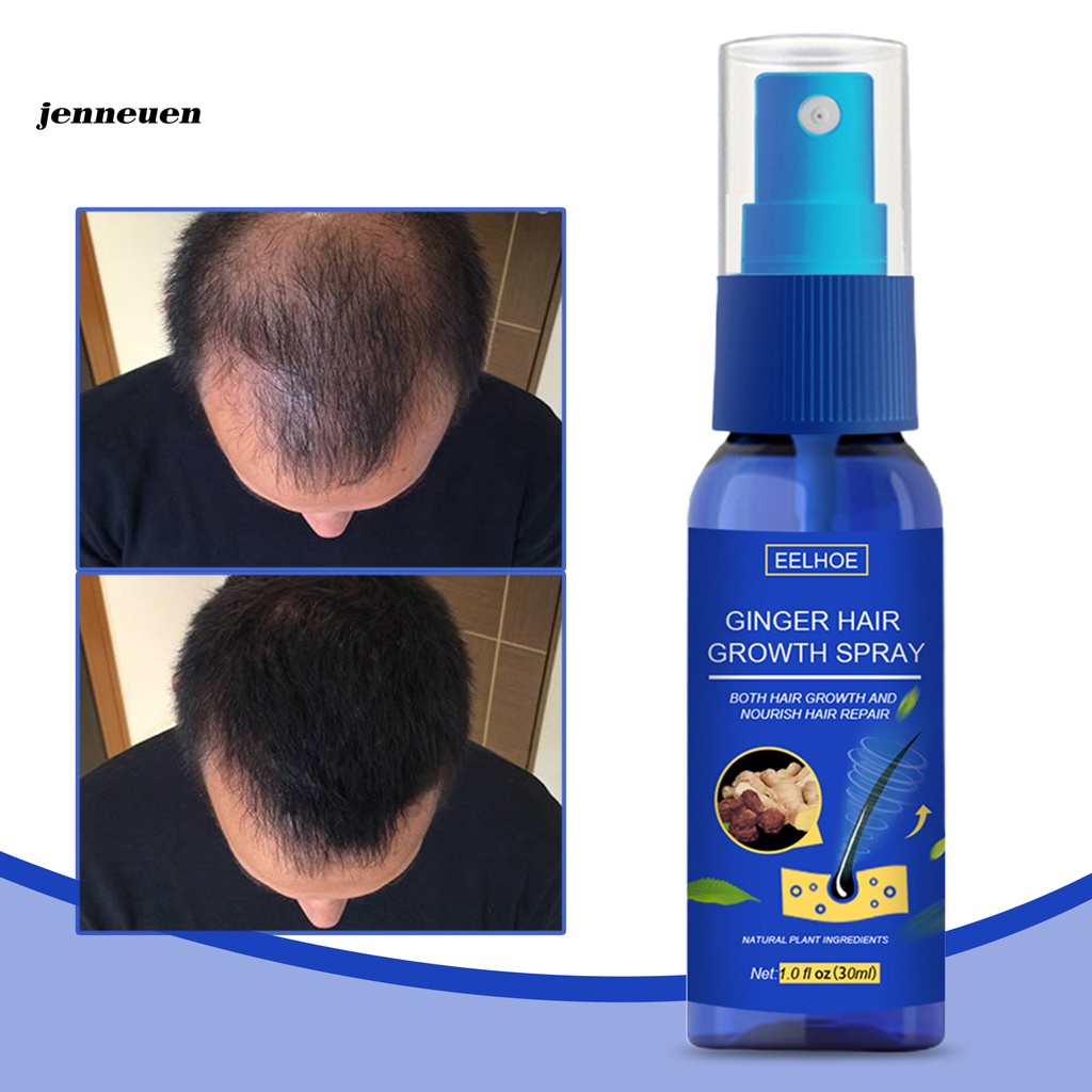 [Hàng mới về] Chai Xịt Kích Thích Mọc Tóc Chiết Xuất Từ Gừng