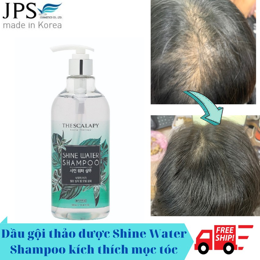 [NHẬP KHẨU] Dầu gội thảo dược Shine Water kích thích mọc tóc, giúp tóc chắc khỏe, vào nếp HOT tại Hàn Quốc
