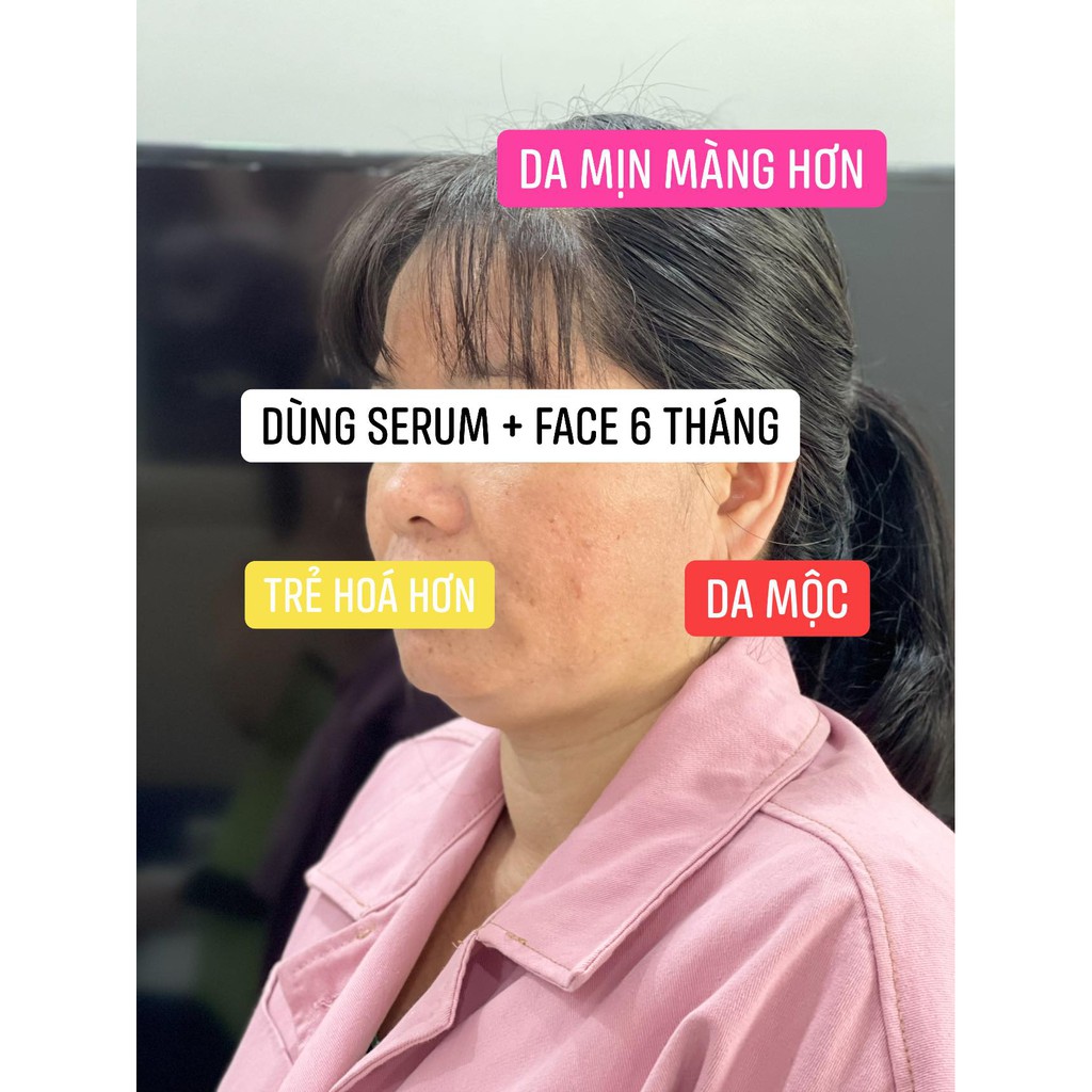 SHOP HIỀN - KEM TRỊ MỤN | BigBuy360 - bigbuy360.vn