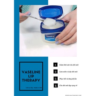 [SIÊU SALE]  SON DƯỠNG MÔI VASELINE TRẮNG 7g XINH XẮN