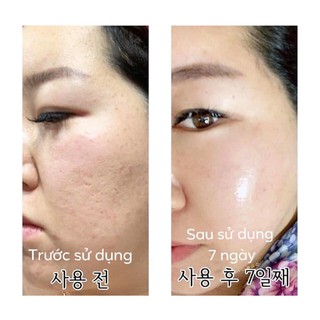 [AUTHENTIC] Set Dưỡng Da Căng Bóng, Trẻ Hóa Da Incellderm