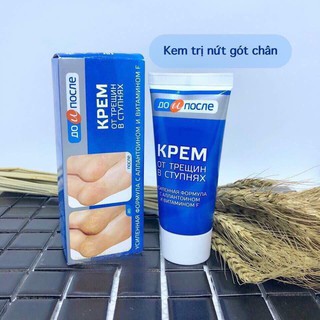 Kem nứt gót chân Kpem của nga