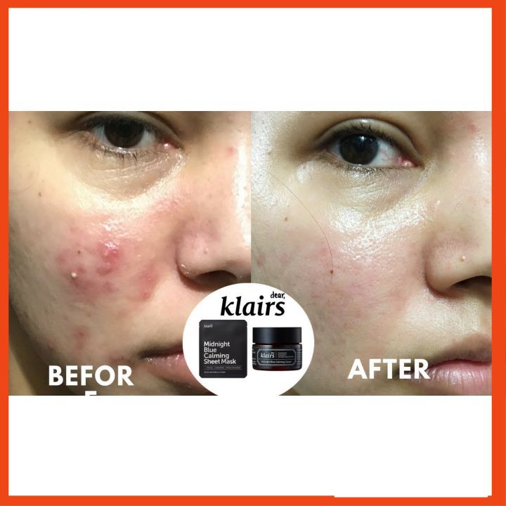 Kem dưỡng Klairs Midnight Blue Calming Cream 60ml | BigBuy360 - bigbuy360.vn