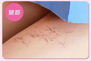Bông tắm kỳ ghét