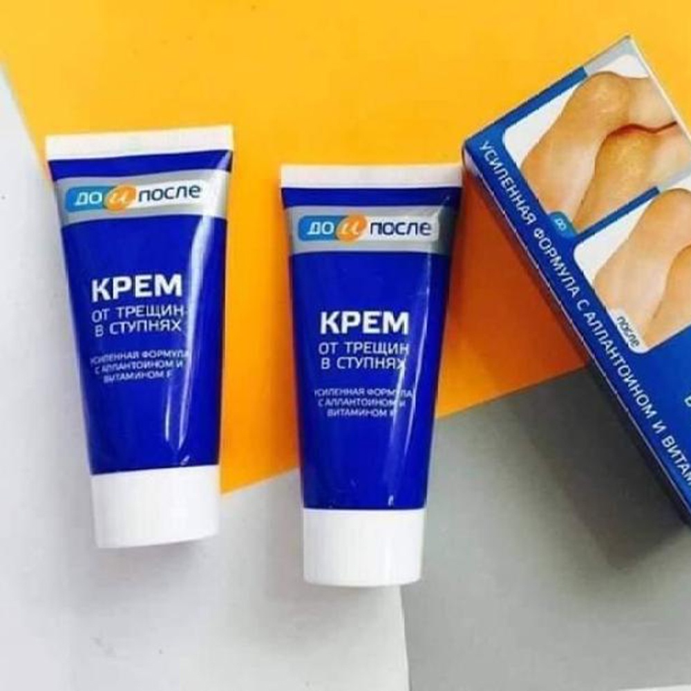 Kem Giảm nứt gót chân Kpem Apteka Nga 50ml Dưỡng Ẩm Làm Mềm Da Chân