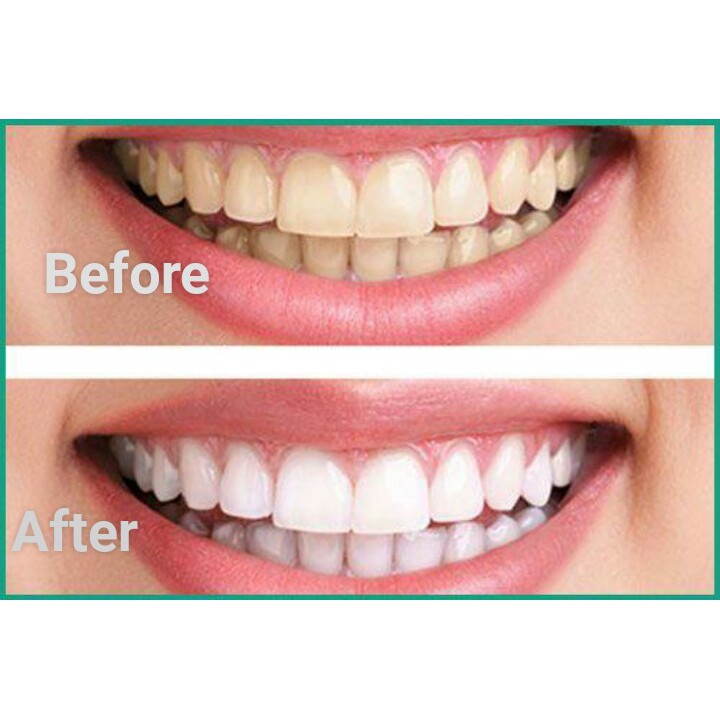 Kem đánh trắng răng AP24 Whitening Fluoride Toothpaste chính hãng của Mỹ