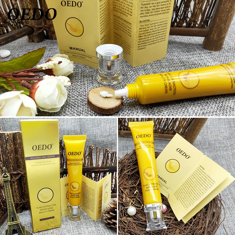 Kem Hỗ Trợ Giảm Mụn OEDO Kiềm Dầu Thu Nhỏ Lỗ Chân Lông Ngăn Ngừa Mụn 20g | BigBuy360 - bigbuy360.vn