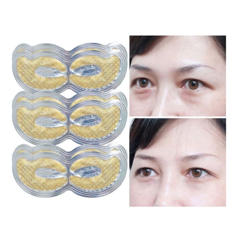 Set 5 cặp mặt nạ mắt Xixi dạng lưới collagen dưỡng ẩm chống nếp nhăn và quầng thâm
 | BigBuy360 - bigbuy360.vn