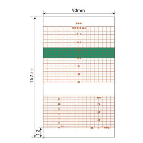 Giấy in monitor sản khoa ED15290P1 152MM X 90MM