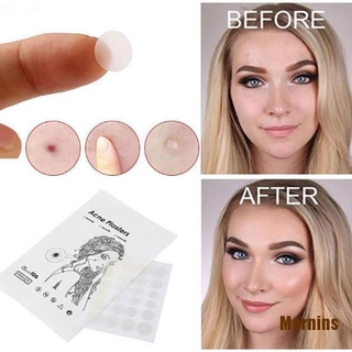 Ms❀Set 36 Miếng Dán Mụn Hydrocolloid Và Mụn Thịt Tiện Dụng
