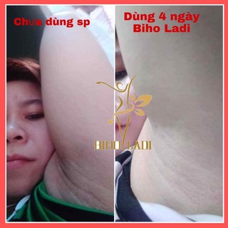 [CHÍNH HÃNG] SIÊU DƯỠNG THÂM 5S BIHO LADI