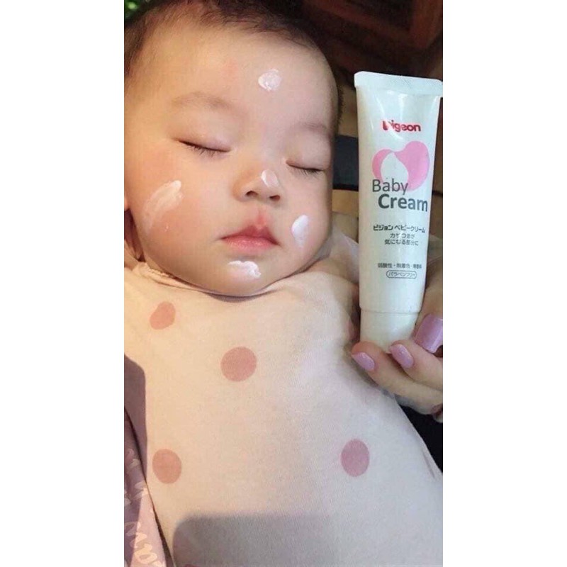 Kem chống nẻ Pigeon Baby Cream cho bé