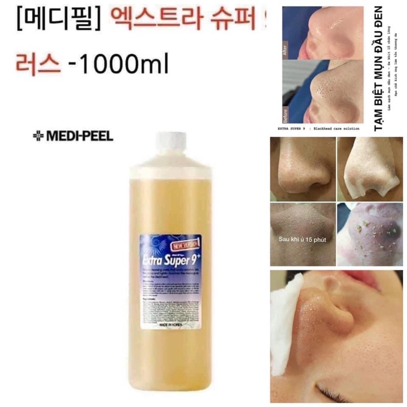 Dung dịch ủ mụn Medipeel Super Extra. Ủ mụn đầu đen sạch, se khít lỗ chân lông | BigBuy360 - bigbuy360.vn