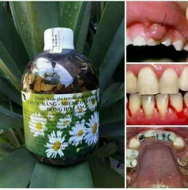 Thuốc răng miệng Thanh Mộc Hương
