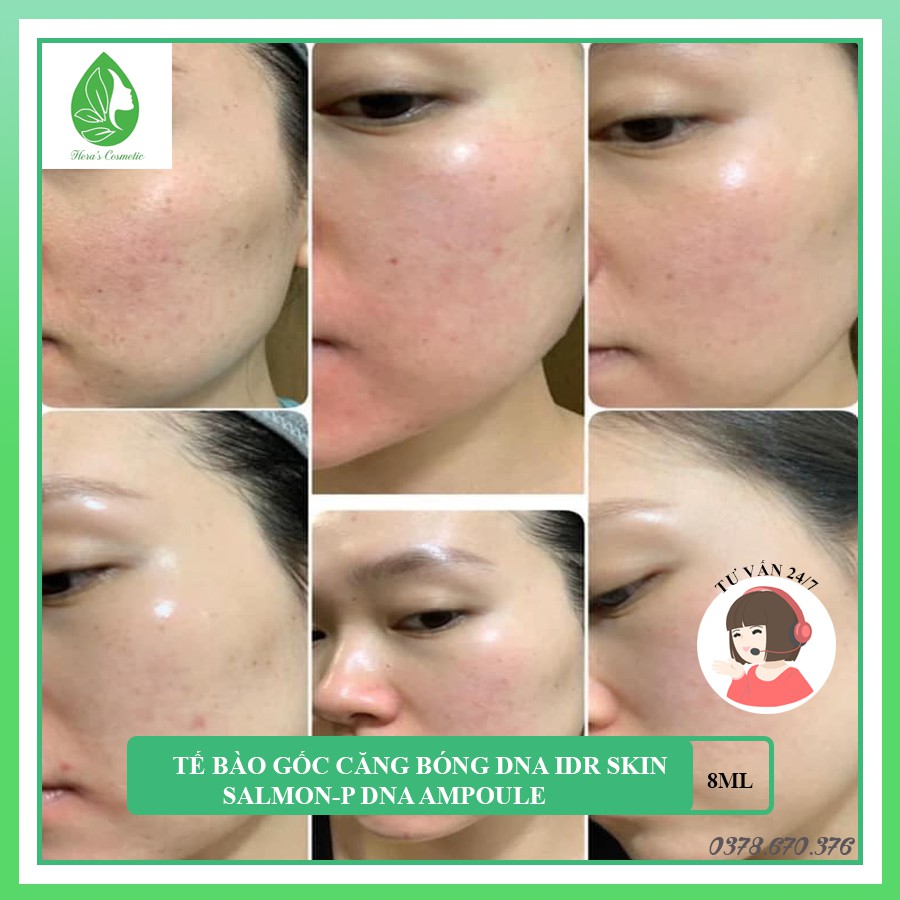 Tế bào gốc DNA cá hồi Idr skin_salmon PDNA Ampoule giúp căng bóng,trẻ hóa da