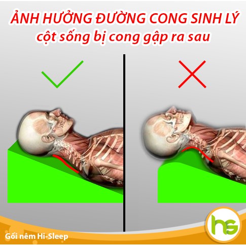 HÀNG THƯƠNG HIỆUGối chống trào ngược cho người lớn Hi-Sleep