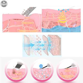 Dụng cụ nặn mụn đầu đen hiệu quả