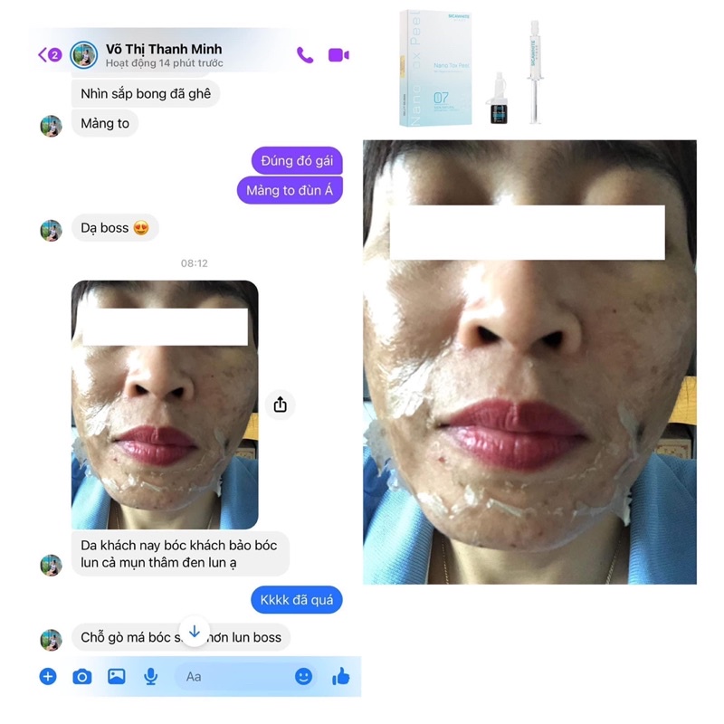 PEEL DA VI TẢO NANO GIÚP LOẠI BỎ LÀN DA KHÔ XẠM TRỞ NÊN MỀM MẠI