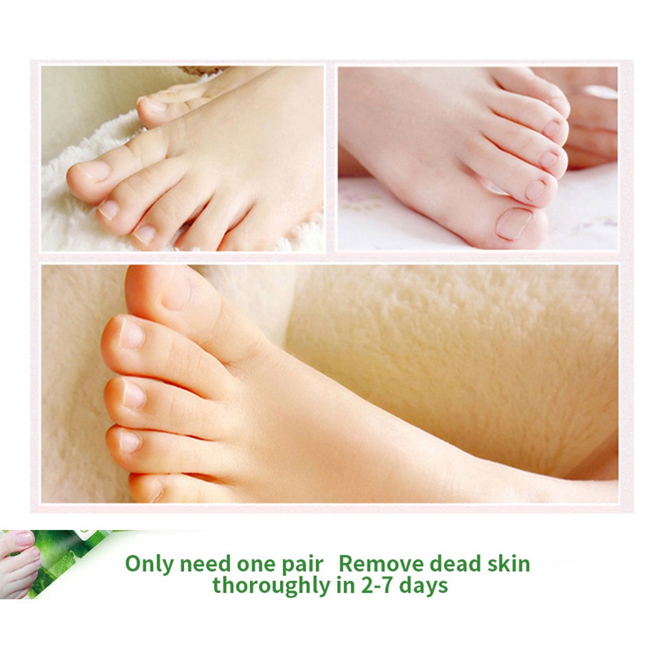 Mặt Nạ Lô Hội Dạng Lột Tẩy Tế Bào Chết Chống Nứt Nẻ Cho Bàn Chân