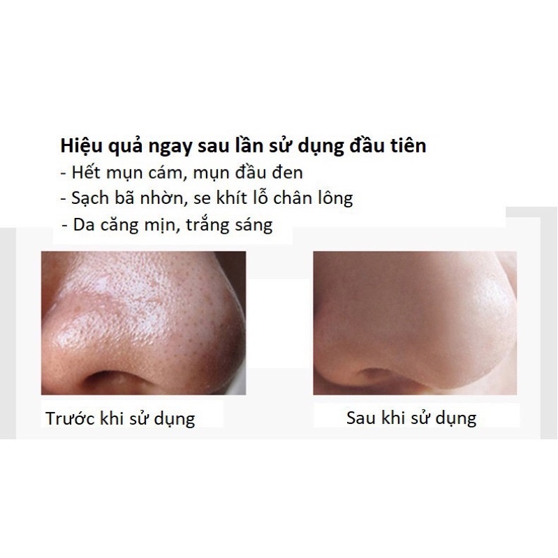 Lột mụn đầu đen Bioaqua tinh chất than tre làm sáng da, sạch da MNB06 (1 miếng)
