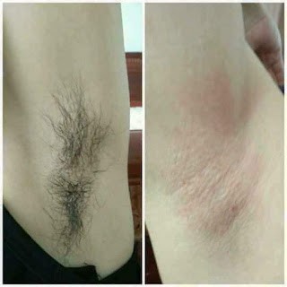Hũ 350gr Veo Wax Lông An Toàn Từ Thiên Nhiên. | BigBuy360 - bigbuy360.vn