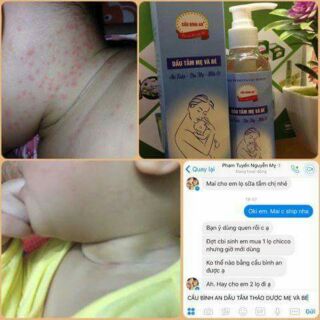 Dầu tắm thảo dược mẹ và bé