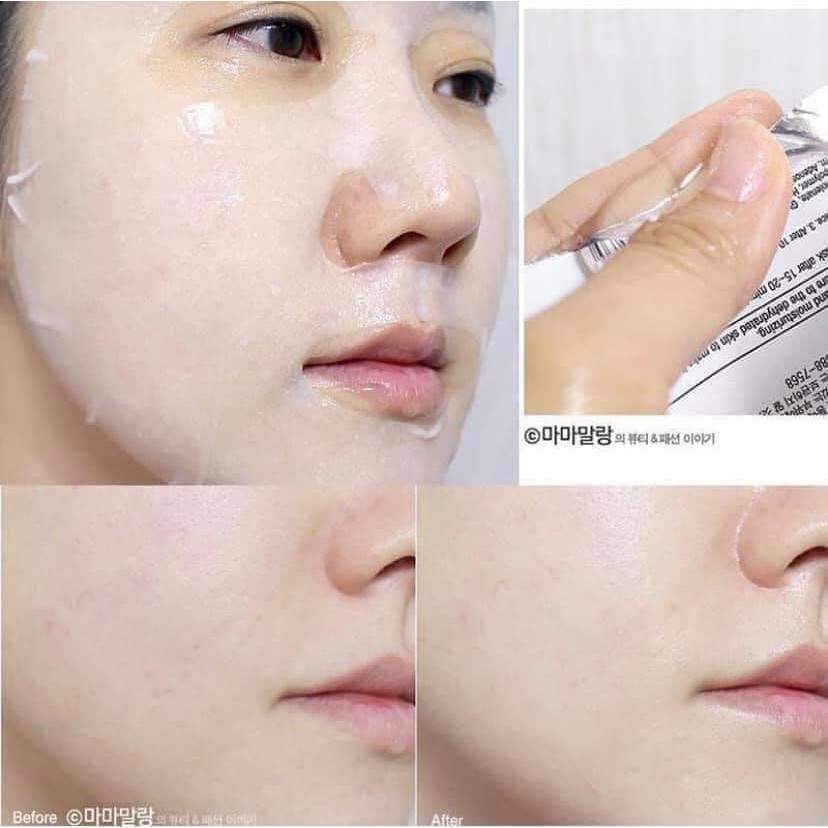 Mặt nạ viên thuốc VitaMin BANOBAGI | BigBuy360 - bigbuy360.vn