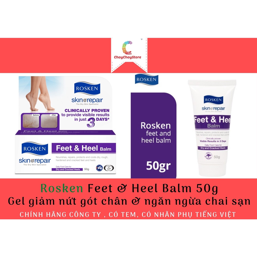 [TEM CÔNG TY] Gel giảm nứt gót chân &amp; ngăn ngừa chai sạn Rosken Feet &amp; Heel Balm 50g