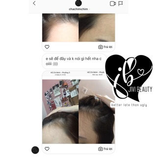 🍋 COMBO GỘI XỊT KÍCH MỌC GIẢM RỤNG ⭐️