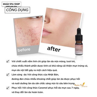 Serum mụn CARAMEL 5ml