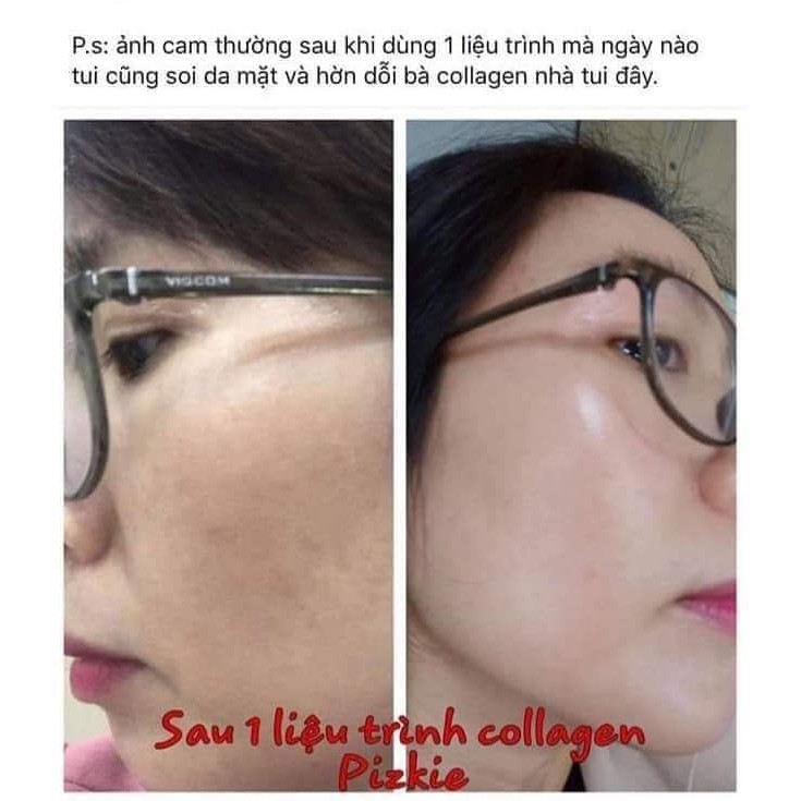 Combo liệu trình 3 gói Collagen cá hồi Pizkie | BigBuy360 - bigbuy360.vn