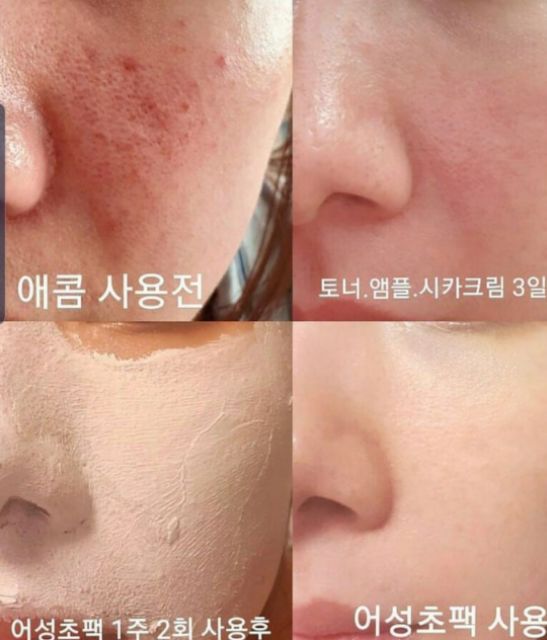 Mặt nạ diếp cá BYECOM HEARTLEAF PURIFYING MASK