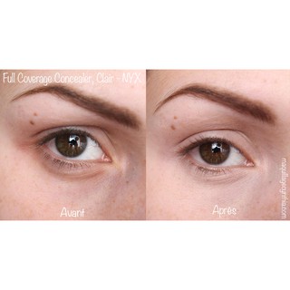 Kem che khuyết điểm NYX full coverage 7gr