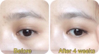 Dưỡng mắt simple dạng lăn