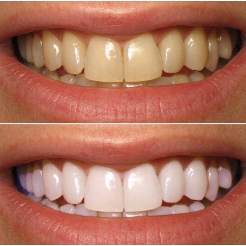 kem đánh răng EUCRYL tẩy trắng răng vị bạc hà 50m ,tẩy da chị những vết ố vàng mảng bám trên răng giúp răng trắng sáng t