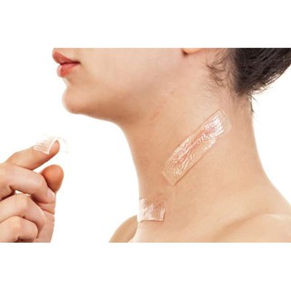 Miếng dán Scar fx 2.5x10cm chuẩn mỹ