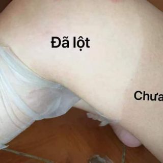 Nước lột da NN