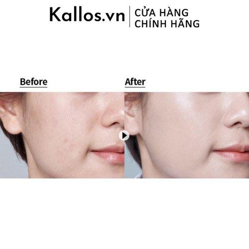 Phấn Nước Laneige Neo Dot Cushion Matte, Laneige Neo Cushion Glow Set 2 Lõi - Kallos Vietnam