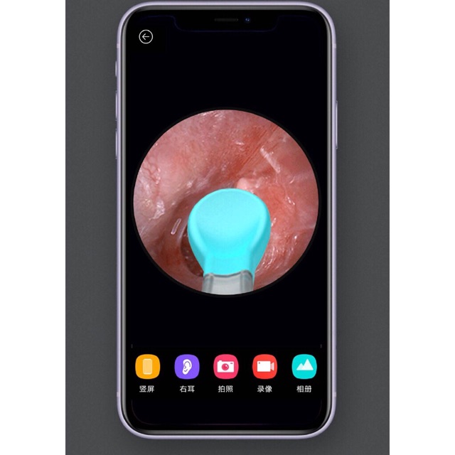 Dụng Cụ Lấy Ráy Tai Thông Minh Xiaomi Bebird M9 Pro - Hàng Chính Hãng