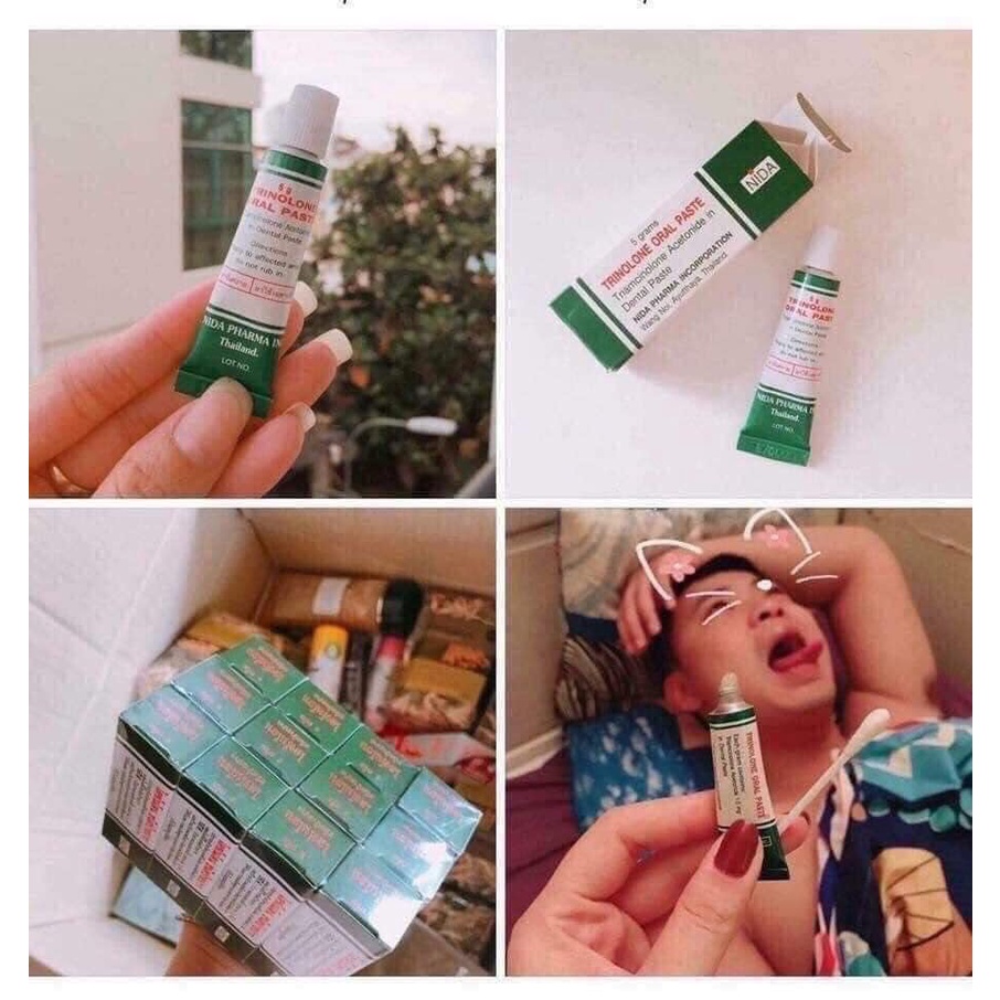 Tuýp Kem Bôi Nhiệt Miệng Trinolone Oral Paste Chính Hãng Thái Lan