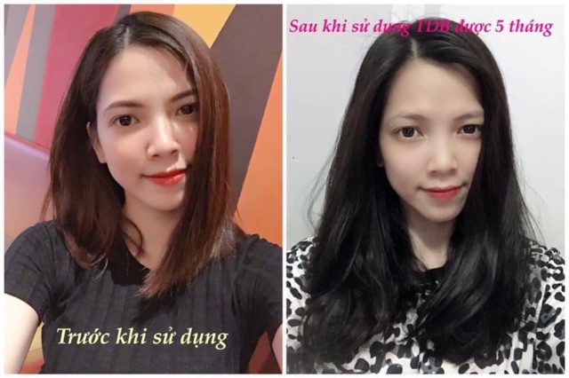 Tinh dầu bưởi trị rụng tóc-kích mọc tóc-dưỡng tóc | BigBuy360 - bigbuy360.vn