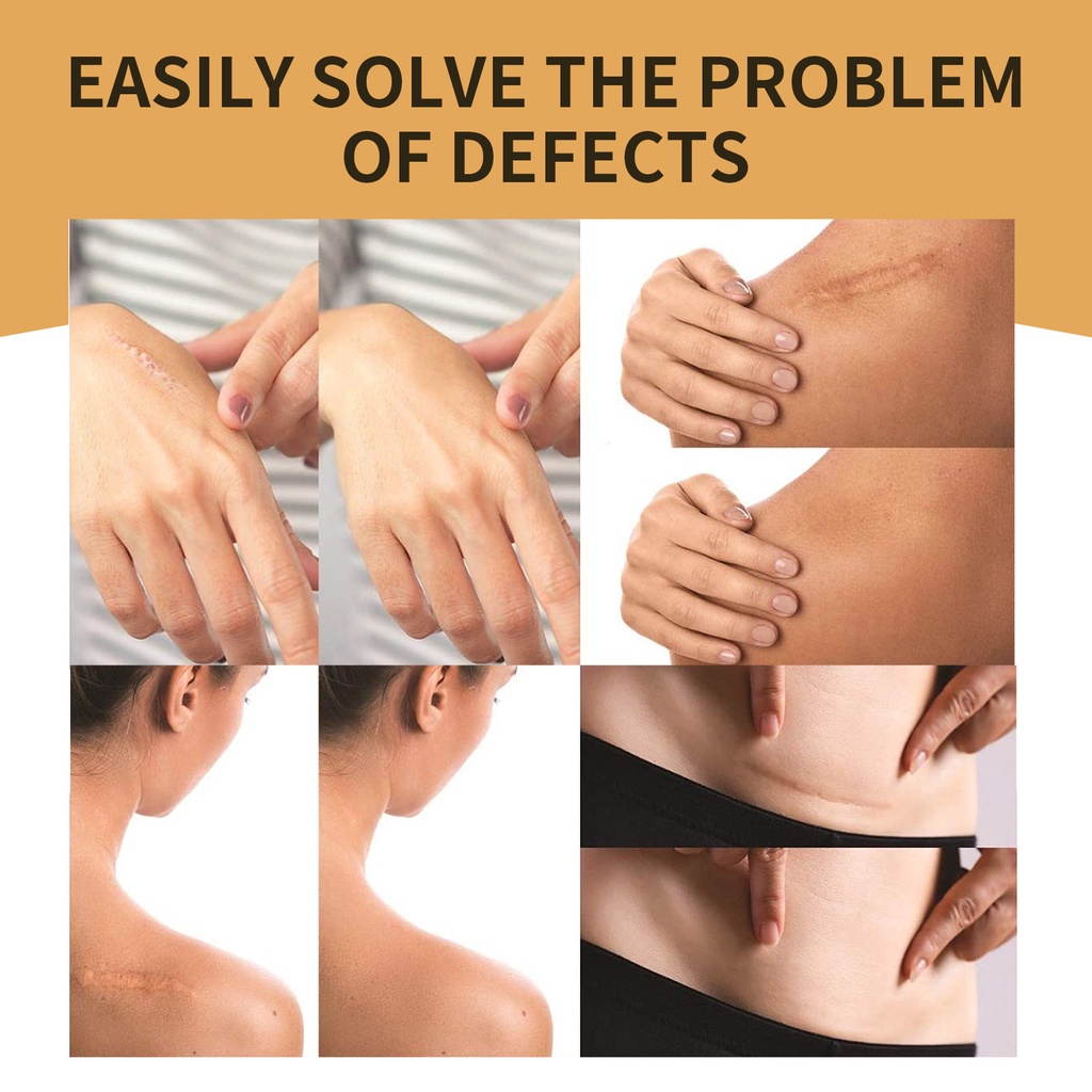 Miếng Che Khuyết Điểm Che Phủ Hình Xăm/Vết Sẹo/Hình Xăm Vô Hình Chống Nước