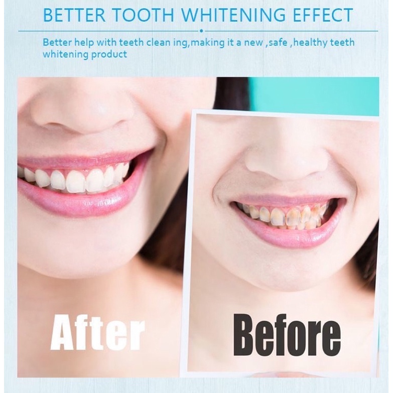 Máy làm trắng răng Smile Kit thế hệ mới - Tẩy trắng răng tại nhà cực đơn giản, hết ố vàng, răng trắng sáng tự nhiên