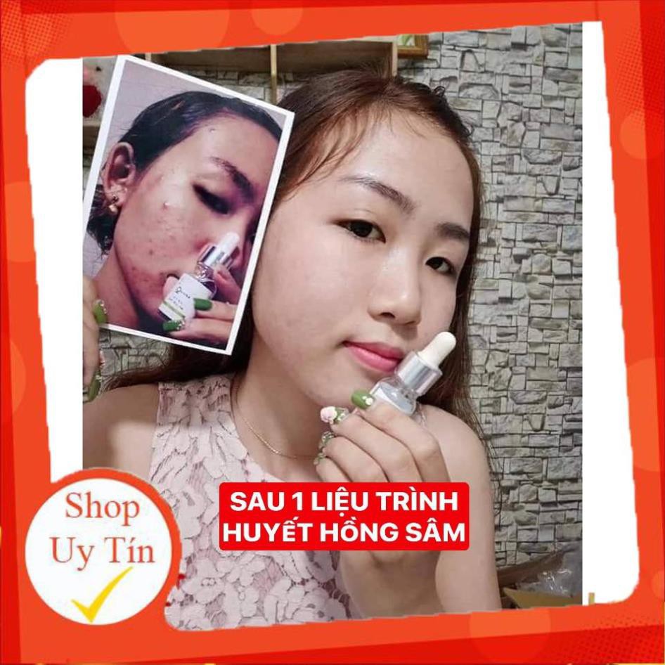 Đặc trị mụn Huyết Hồng Sâm - 100% từ thảo mộc thiên nhiên, giá rẻ - Đông Dược Vũ Đức | BigBuy360 - bigbuy360.vn