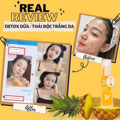Detox Dứa Queenie Skin - Detox Thải Độc Dứa Trắng Da Queenie Skin