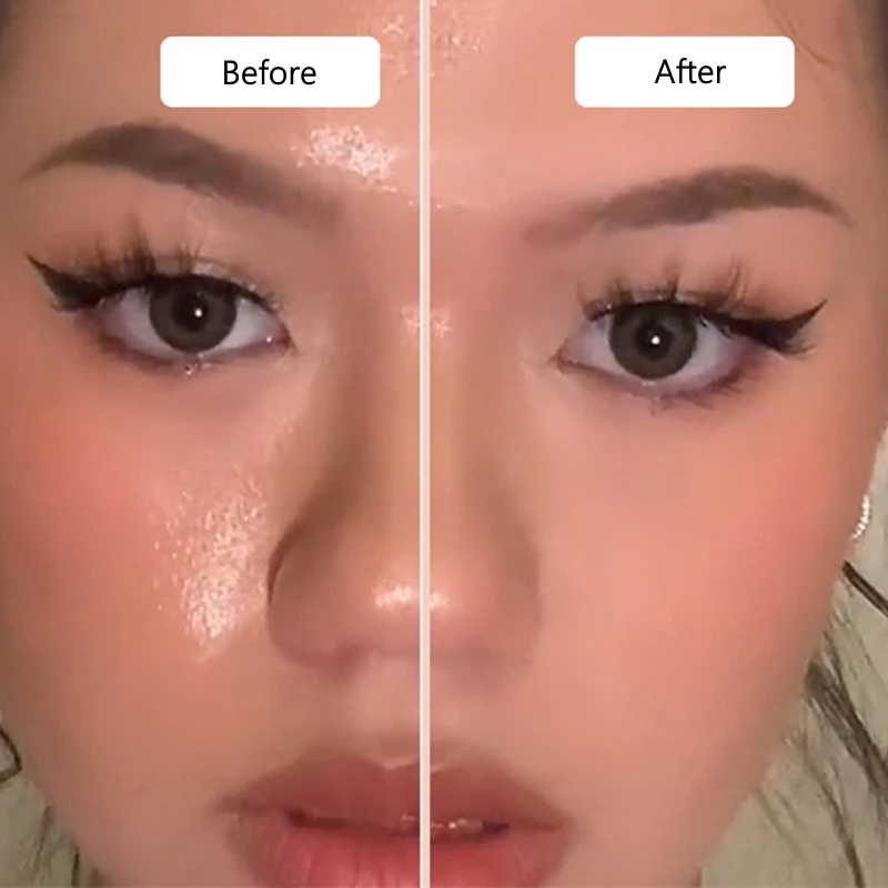 Cây Lăn Đá Núi Lửa / Dầu Loại Bỏ Vùng Chữ T Chăm Sóc Da Mặt Có Thể Giặt Lại Salorie